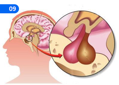 Function of the Human Prostate Gland,මිනිස‍ාගේ නිර්නාල ග්‍රන්ථින්ගේ ක්‍රියාකාරිත්වය,Grade 5 Health & Physical Education Lessons ,Grade 5 Health & Physical Education Paadam